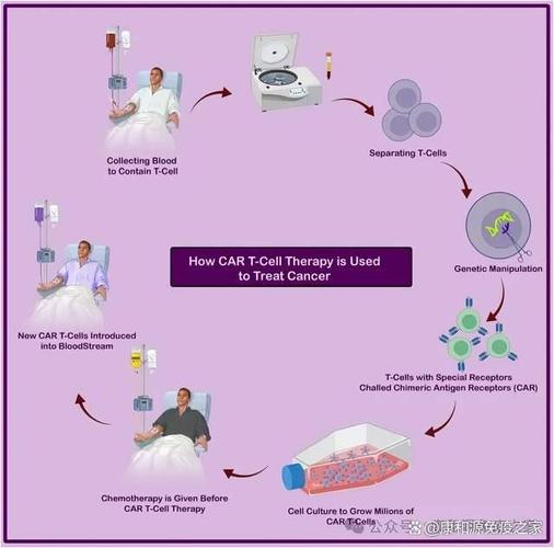異體CAR-T細(xì)胞療法治療自身免疫病，專家解讀
